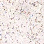 Cytochrome P450 Reductase Antibody in Immunohistochemistry (Paraffin) (IHC (P))