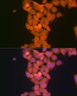 p53DINP1 Antibody in Immunocytochemistry (ICC/IF)