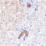 p53DINP1 Antibody in Immunohistochemistry (Paraffin) (IHC (P))