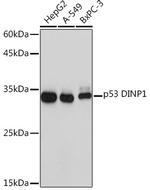 p53DINP1 Antibody in Western Blot (WB)