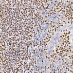 IKZF3 Antibody in Immunohistochemistry (Paraffin) (IHC (P))