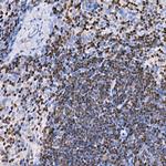 IKZF3 Antibody in Immunohistochemistry (Paraffin) (IHC (P))