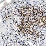 IKZF3 Antibody in Immunohistochemistry (Paraffin) (IHC (P))