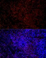 IKZF3 Antibody in Immunohistochemistry (Paraffin) (IHC (P))