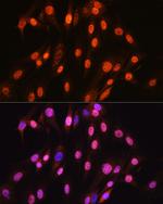 SOX10 Antibody in Immunocytochemistry (ICC/IF)