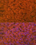 RBP4 Antibody in Immunohistochemistry (Paraffin) (IHC (P))