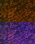 RBP4 Antibody in Immunohistochemistry (Paraffin) (IHC (P))