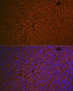 RBP4 Antibody in Immunohistochemistry (Paraffin) (IHC (P))