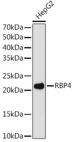 RBP4 Antibody in Western Blot (WB)