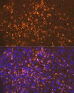 Neutrophil elastase Antibody in Immunohistochemistry (Paraffin) (IHC (P))