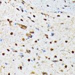 CaMKIV Antibody in Immunohistochemistry (Paraffin) (IHC (P))