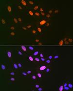 DNA Ligase I Antibody in Immunocytochemistry (ICC/IF)