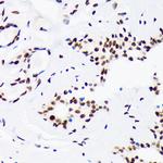 DNA Ligase I Antibody in Immunohistochemistry (Paraffin) (IHC (P))