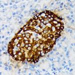 Chromogranin A Antibody in Immunohistochemistry (Paraffin) (IHC (P))