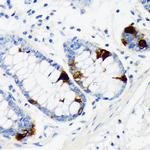 Chromogranin A Antibody in Immunohistochemistry (Paraffin) (IHC (P))