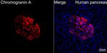 Chromogranin A Antibody in Immunohistochemistry (Paraffin) (IHC (P))