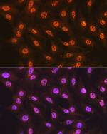 SF3B1 Antibody in Immunocytochemistry (ICC/IF)