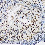 SF3B1 Antibody in Immunohistochemistry (Paraffin) (IHC (P))