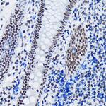 SF3B1 Antibody in Immunohistochemistry (Paraffin) (IHC (P))