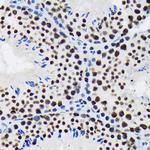 SF3B1 Antibody in Immunohistochemistry (Paraffin) (IHC (P))