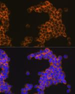 CD30 Antibody in Immunocytochemistry (ICC/IF)