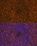 CD30 Antibody in Immunohistochemistry (Paraffin) (IHC (P))