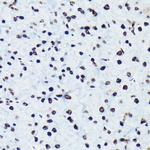 Phospho-Rb (Ser780) Antibody in Immunohistochemistry (Paraffin) (IHC (P))