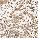 Phospho-STAT3 (Tyr705) Antibody in Immunohistochemistry (Paraffin) (IHC (P))