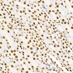 Phospho-STAT3 (Tyr705) Antibody in Immunohistochemistry (Paraffin) (IHC (P))