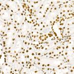 Phospho-STAT3 (Tyr705) Antibody in Immunohistochemistry (Paraffin) (IHC (P))