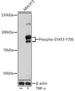 Phospho-STAT3 (Tyr705) Antibody in Western Blot (WB)