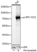 Phospho-BTK (Tyr223) Antibody in Western Blot (WB)