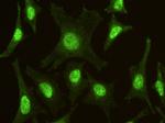 IRF6 Antibody in Immunocytochemistry (ICC/IF)