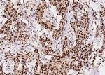 PCNA Antibody in Immunohistochemistry (Paraffin) (IHC (P))