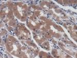 UCP2 Antibody in Immunohistochemistry (Paraffin) (IHC (P))