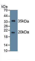 SPINK5 Antibody in Western Blot (WB)