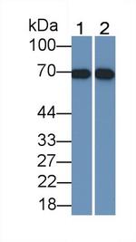 SLC22A4 Antibody in Western Blot (WB)