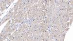 SEMA5B Antibody in Immunohistochemistry (Paraffin) (IHC (P))