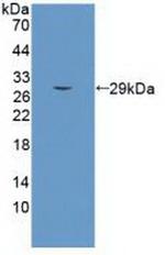 SEMA5B Antibody in Western Blot (WB)