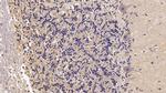 SEMA5B Antibody in Immunohistochemistry (Paraffin) (IHC (P))