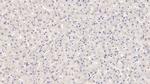 ROS1 Antibody in Immunohistochemistry (Paraffin) (IHC (P))