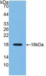 RNASE3 Antibody in Western Blot (WB)