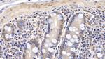 RARS Antibody in Immunohistochemistry (Paraffin) (IHC (P))