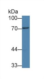 PADI3 Antibody in Western Blot (WB)