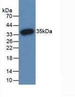 PADI3 Antibody in Western Blot (WB)