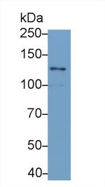 Laminin gamma-2 Antibody in Western Blot (WB)