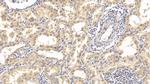 Interferon alpha-21 Antibody in Immunohistochemistry (Paraffin) (IHC (P))