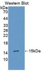 TGF alpha Antibody in Western Blot (WB)