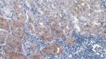 HGF Antibody in Immunohistochemistry (Paraffin) (IHC (P))