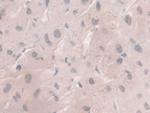 HFE2 Antibody in Immunohistochemistry (Paraffin) (IHC (P))